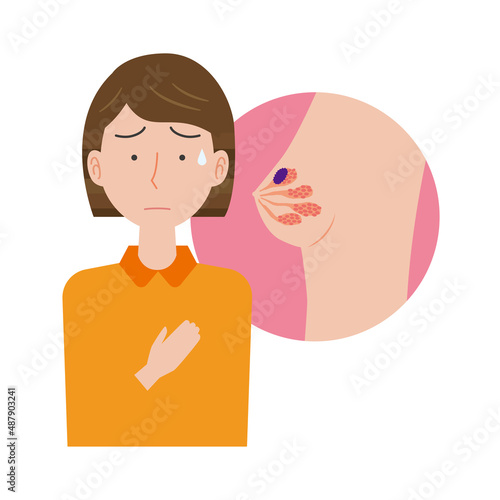 乳がんを心配する女性