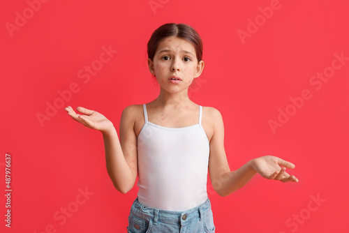 Fotografie Little girl ill with chickenpox on red background