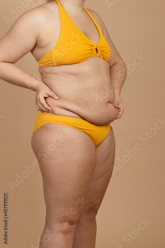 Cropped vertical photo overweight fat woman holding tummy flabs, obesity, excess fat in yellow swimsuit. Fast weight loss. Cellulite. Go on unhealthy diet. Pregnant woman, dehydrated, varicose veins