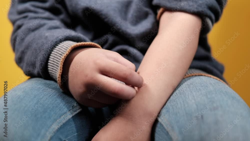 slow motion of child girl suffering from itching skin, close up. slow motion of child girl suffering from itching skin, close up.