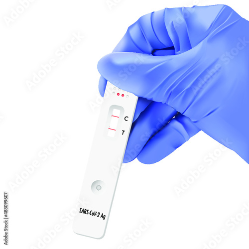 Vector ilustration of positive diagnostic resut of rapid test on covid sars CoV-19 or coronavirus disease in hand in blue medical gloves. Text of test card on english "SARS-CoV-2 Ag"