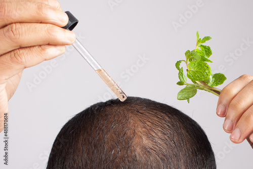 bald man using Peppermint essential hair oil in a dropper photo