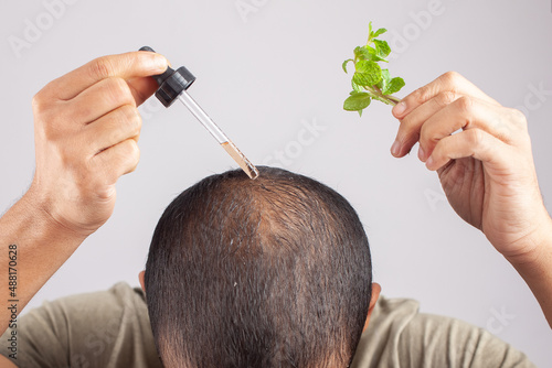 Peppermint essential oil for hair loss treatment photo