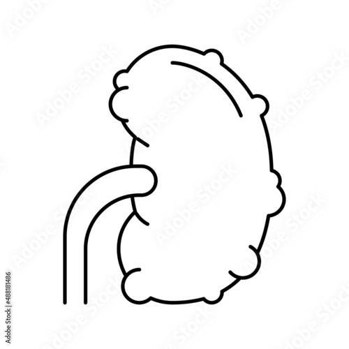 chronic pyelonephritis line icon vector illustration