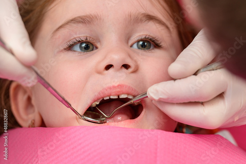 The dentist examines the baby girl's baby teeth, the treatment of baby teeth, the dentist holds a mirror.