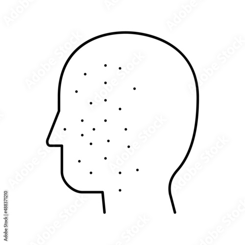 acne disease line icon vector illustration