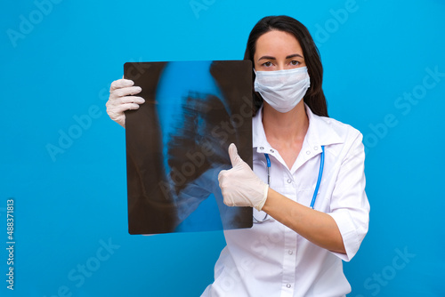 the doctor holds an X-ray of the spine in his hands, the patient has scaliosis.