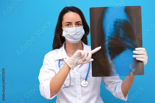 the doctor holds an X-ray of the spine in his hands, the patient has scaliosis.