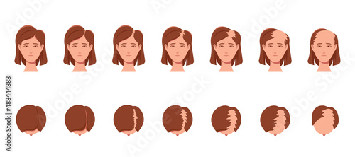 Hair Grow or Loss Process Stages, Baldness of Women. Female Characters Head Top and Front View. Health and Aging