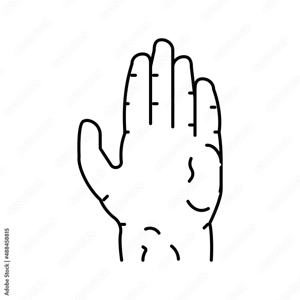 scleroderma skin disease line icon vector illustration scleroderma skin disease line icon vector illustration