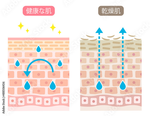 乾燥肌　断面　ビフォアアフター