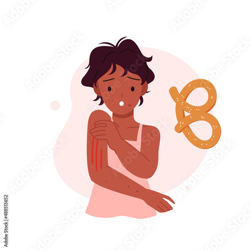 Itching allergic symptom in sick child vector illustration. Cartoon unhealthy girl scratching arms after eating wheat bun, allergens in food isolated on white. Gluten allergy, medicine concept