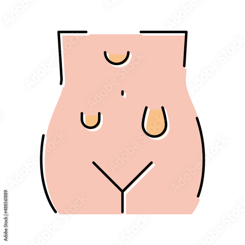 abdominal hernias disease color icon vector illustration