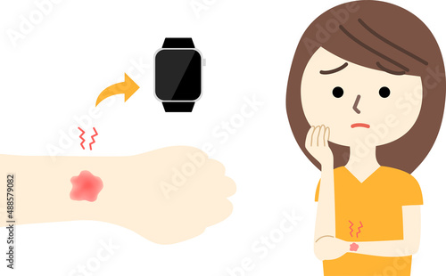 スマートウォッチで手首がかぶれてしまった女性