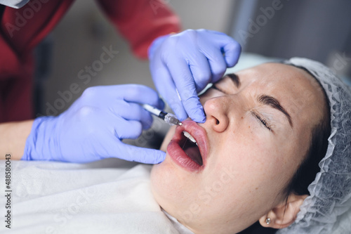 Cosmetologist doing painful lip augmentation procedure with hyaluronic acid. The beautician pierces lips by needle. Woman suffering subcutaneous injection to increase lips shape with dermal filler.