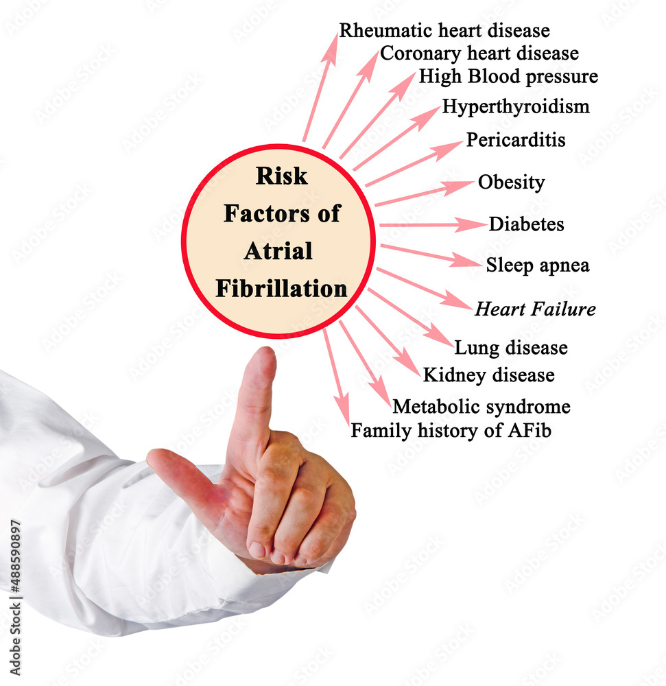 Risk factors of atrial fibrilation Risk factors of atrial fibrilation