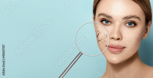 Female face with dry facial skin showing dehydrated and dry skin with magnifying glass on blue background. Cracked dry skin without moistening