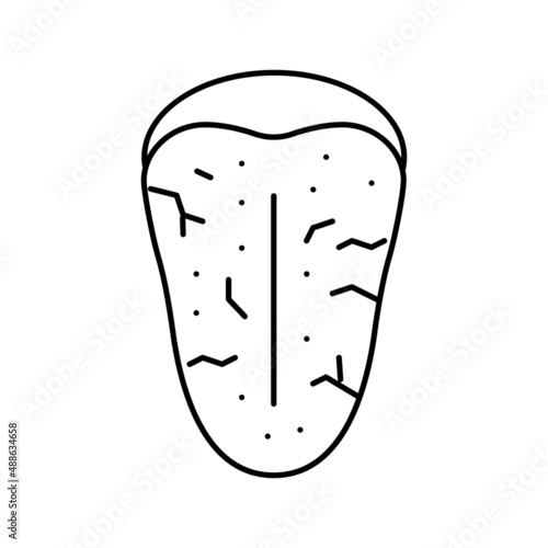 sjogrens syndrome line icon vector illustration