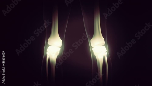 Medical concept of pain in the knee joint photo