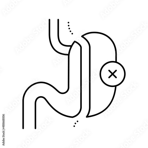 sleeve resection bariatric line icon vector illustration