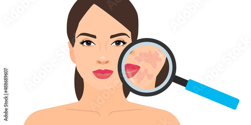 dermatology magnifying glass woman face skin problem skincare vector illustration