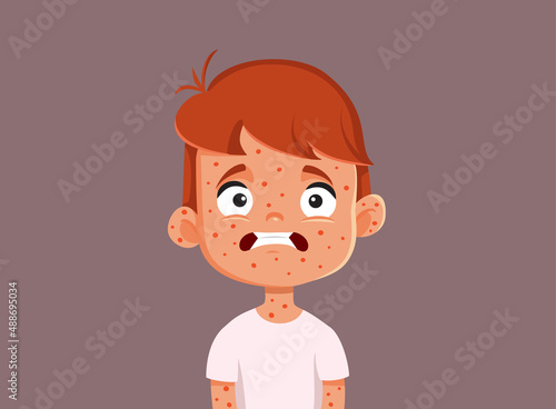 Child Suffering from Measles Vector Cartoon Illustration photo