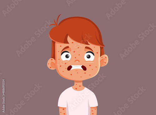 Child Suffering from Measles Vector Cartoon Illustration