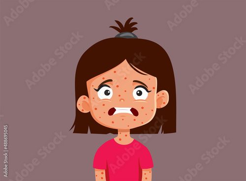 Little Girl Suffering from Measles Vector Cartoon Illustration