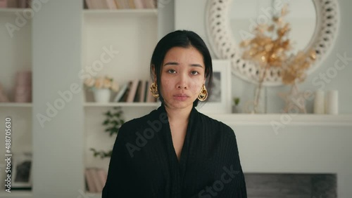 Young Asian Beautiful Girl girl with problem skin. Acne treatment stages - 15th day of 27. Commercial ready woman skin care concept.