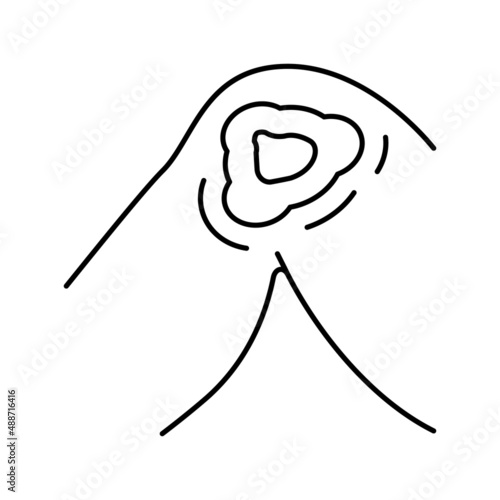 cutaneous mucormycosis line icon vector illustration