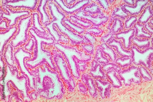 Seminal vesicle, LM