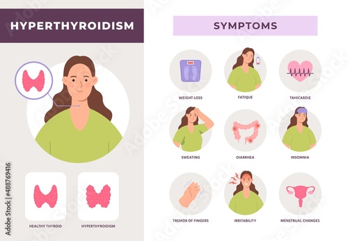 Hyperthyroidism symptoms infographic, overactive thyroid gland disease. Endocrine system health info with flat woman character vector poster