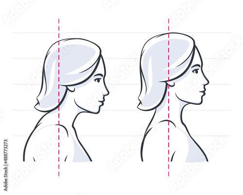 Posture correction. Neck position. Good, right or bad, wrong, incorrect spine seat position. Correct posture neck, back vector illustration