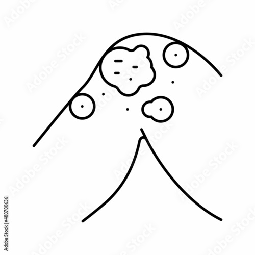atopic dermatitis line icon vector illustration