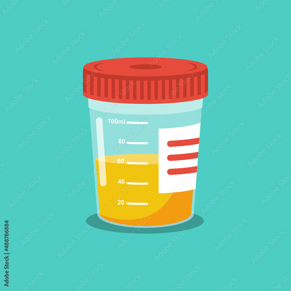 Urine analysis. Urine test icon. Pee sample in a plastic box. Medical