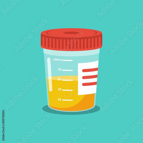 Urine analysis. Urine test icon. Pee sample in a plastic box. Medical sample in a glass tube. Laboratory container. Vector illustration flat cartoon design. Isolated on white background.