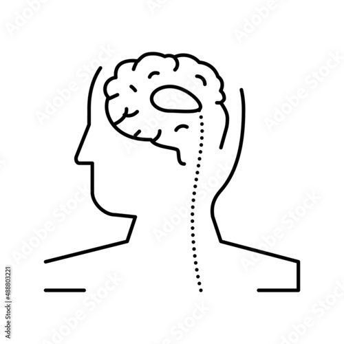 shunt insertion or revision line icon vector illustration