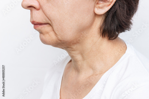 The lower part of the face and neck of an elderly woman with signs of skin aging isolated on a white background. Age-related changes, flabby sagging facial skin. Cosmetology and beauty concept photo