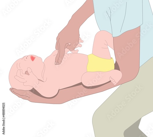 Choking first aid baby food CPR child step lodges blocking victim adult help abdomen kids conscious poster swallow back blows chest rescue breath care safety photo