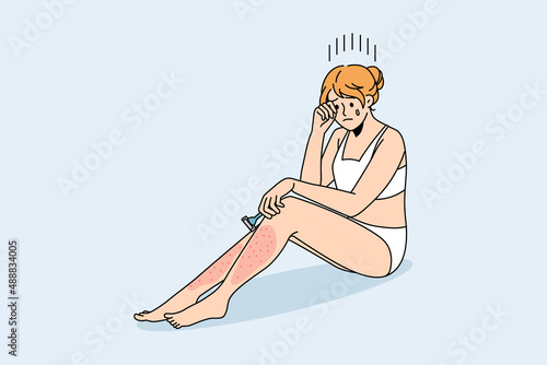 Skin problems after shaving concept. Young crying female sitting with red sore legs having problems with shaving vector illustration 