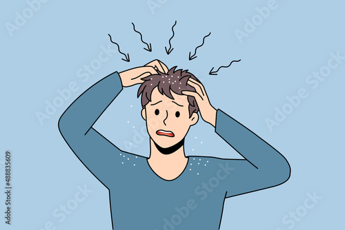 Itchy head and dandruff concept. Stressed irritated man standing and having itchy scalp feeling problems with health and scratching hair vector illustration 