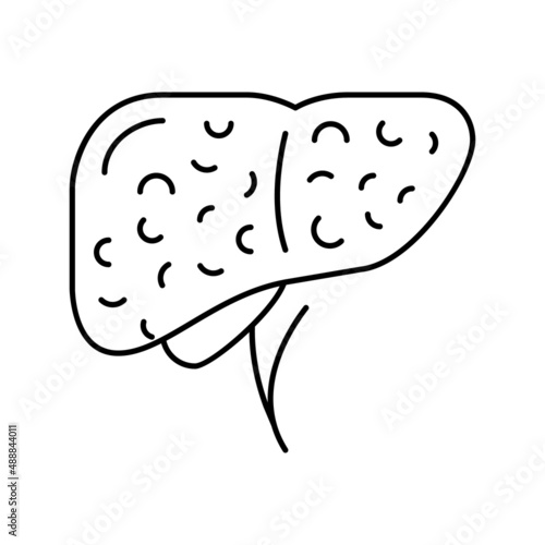 liver cirrhosis disease line icon vector illustration