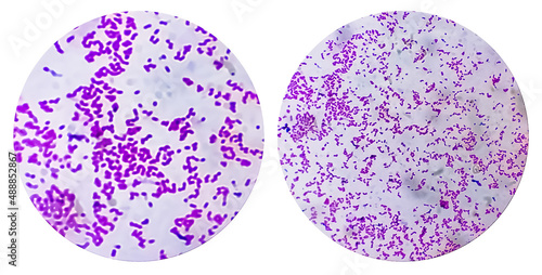 Photo collage of two microscopic image of Escherichia coli bacterium, E.coli, gram-negative rod-shaped bactetium. photo