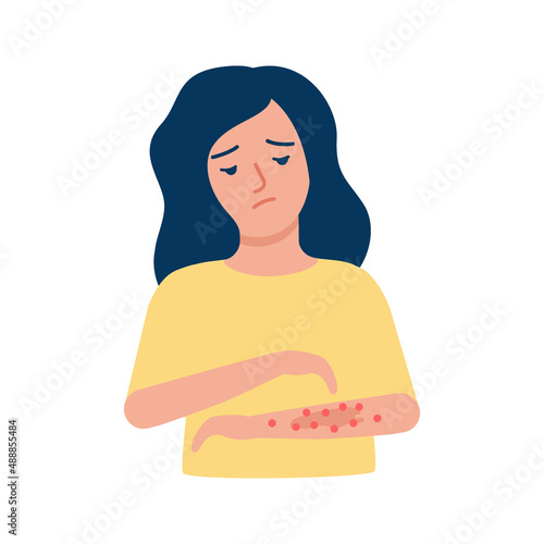 Woman scratching arm, rash, allergy, acne on skin. Girl suffering from itchy skin, symptom disease. Vector illustration