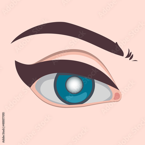 Eye disease vector illustration, Glaucoma cataract and healthy eye disease and nephropathy problems