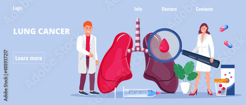 Lung cancer concept vector. Pleurisy, tuberculosis, pneumonia illustration for website, header, blog. Lung diagnosis x-ray machine.