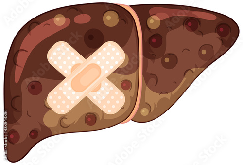 Fibrosis liver with cross plasters on white background