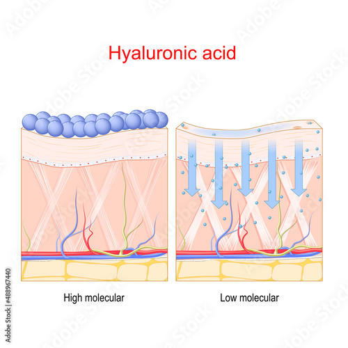Hyaluronic acid. Penetration in the skin of Low and High molecule