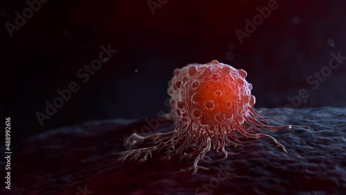Cancer cells can migrate to other body tissues or organs building metastasis. 3D animation