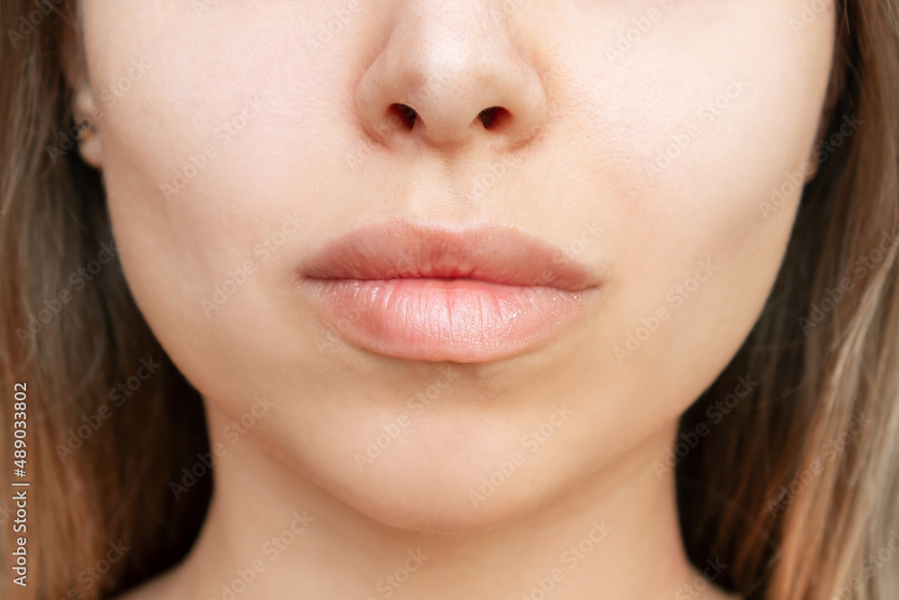Obraz premium Cropped shot of young caucasian blonde woman's face with perfect lips after lip enhancement. Injection of filler in lips. Result of a lip augmentation. Close-up